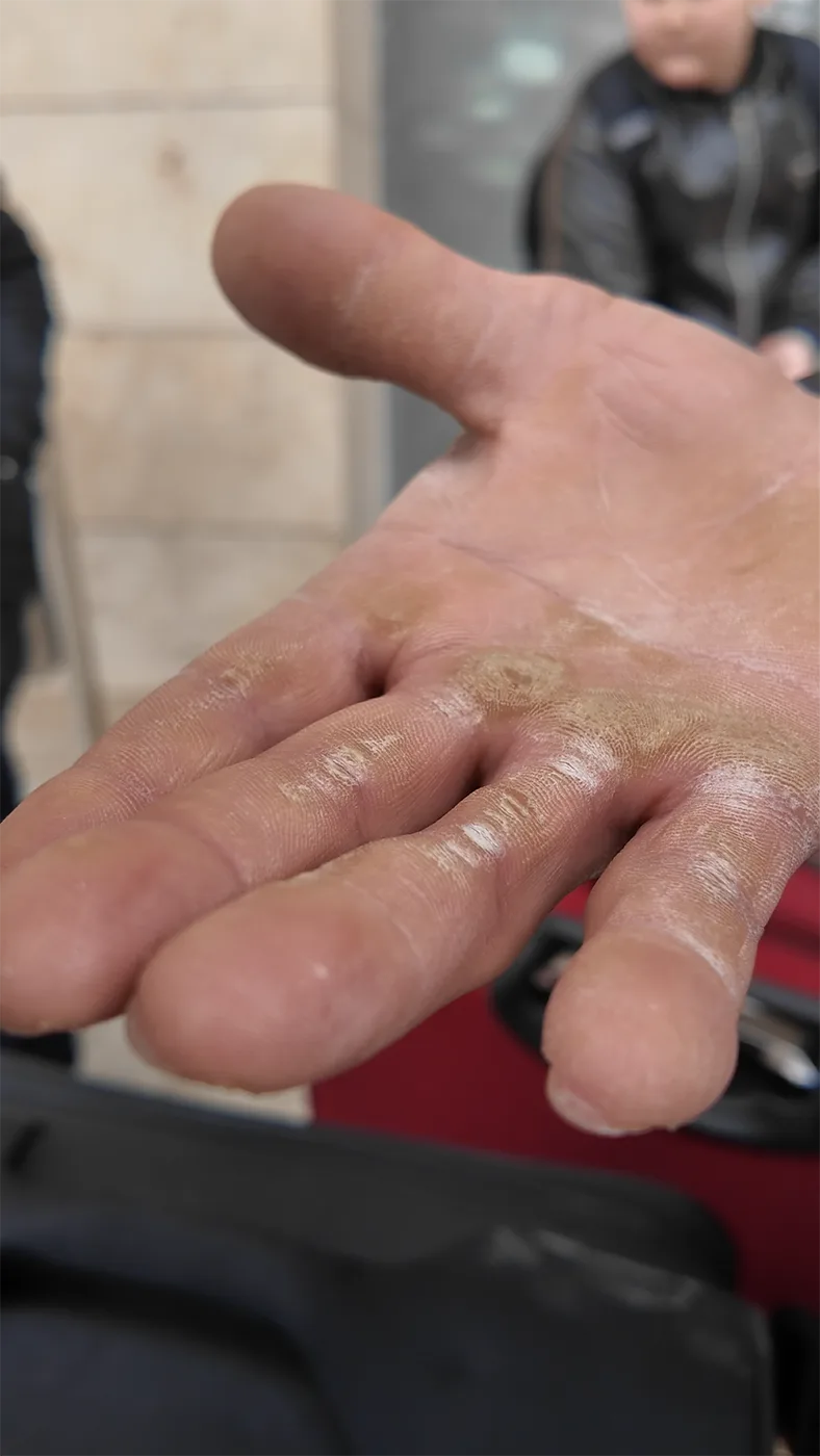 Tedeschi Le Mani Di Ahmad